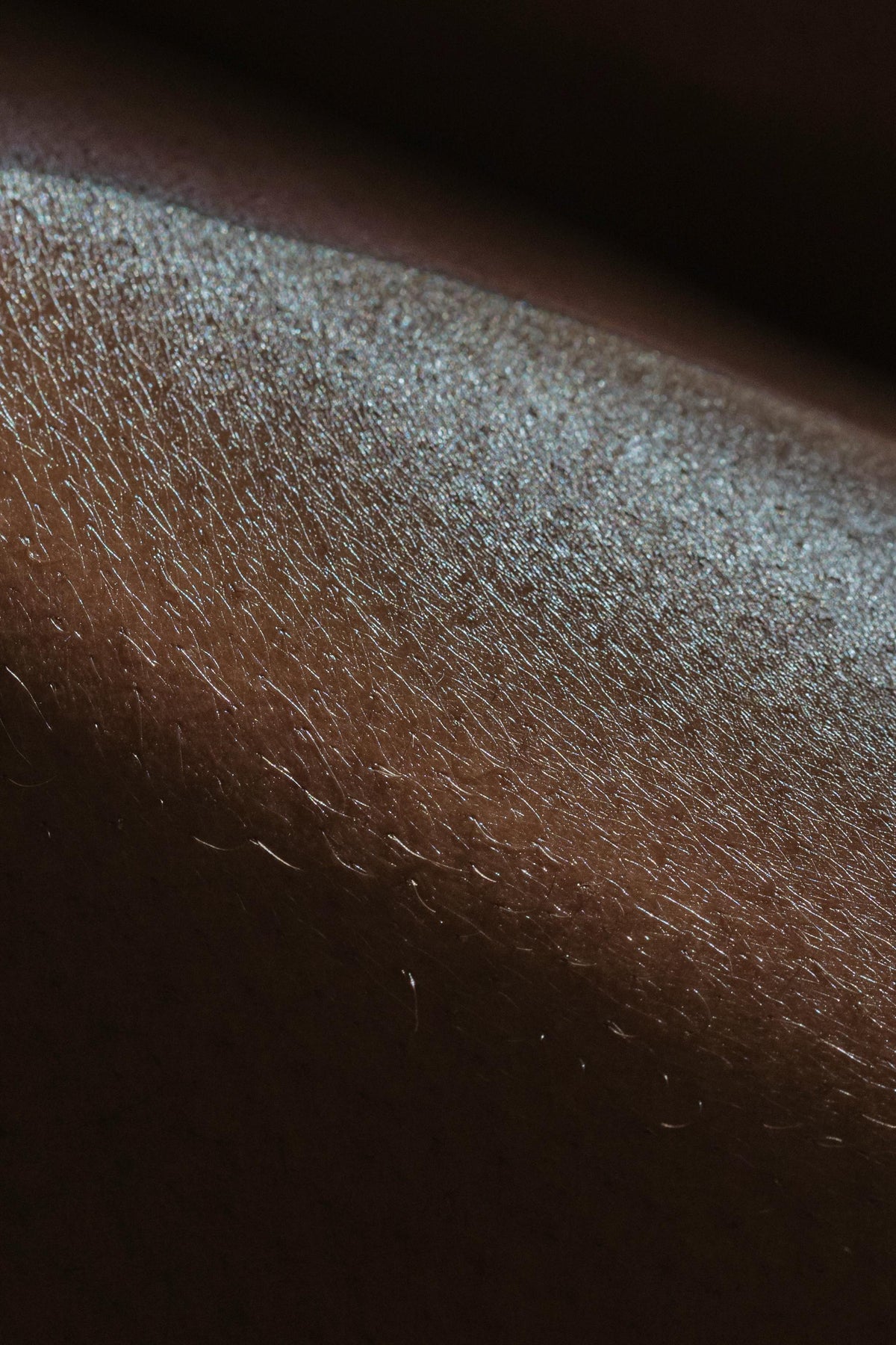 Dark Spots on Melanin-Rich Skin: Why They Happen (And How to Prevent Them)